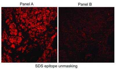 Immunohistological Detection of Carbonic Anhydrase IX/CA9 in Human RCC Tumor Cryosections